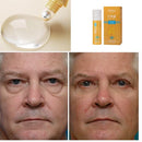 Rolon 5 em 1 Ultra Rejuvenescedor - Luteína Glow® [FRETE GRÁTIS]