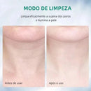Massageador Facial com Fototerapia Anti-Rugas [FRETE GRÁTIS]