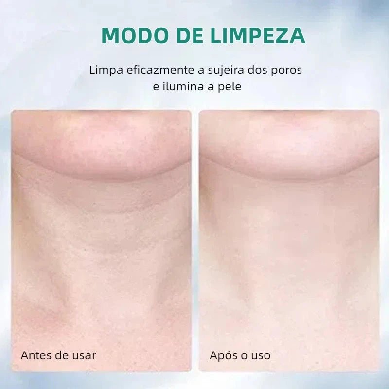 Massageador Facial com Fototerapia Anti-Rugas [FRETE GRÁTIS]