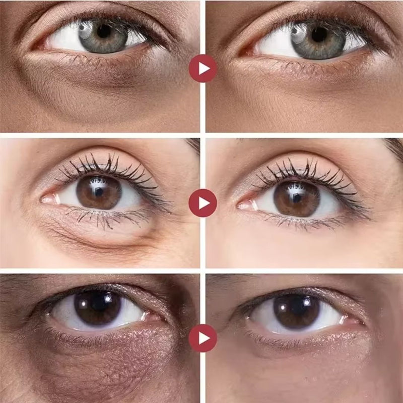 Rolon 5 em 1 Ultra Rejuvenescedor - Luteína Glow® [FRETE GRÁTIS]